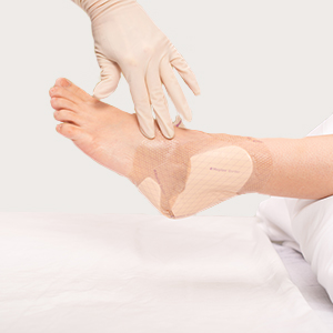 Steg 6 i appliceringen av Mepilex Border Heel