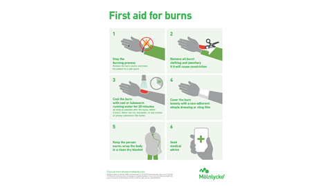 Infografik om första hjälpen vid brännskador