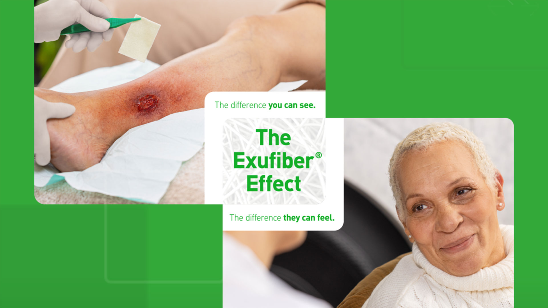 Exufiber‑effekten